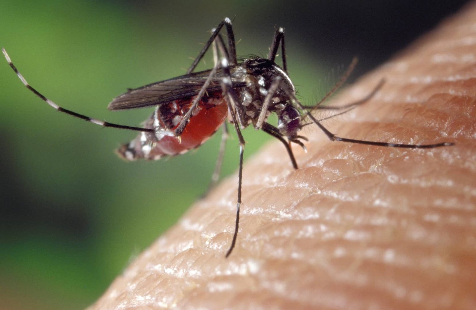 What are the neurological symptoms of Zika virus? Know the details